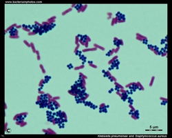 micrograph of a Gram-stained smear of klebsiebsiella and staphylococcus aureus